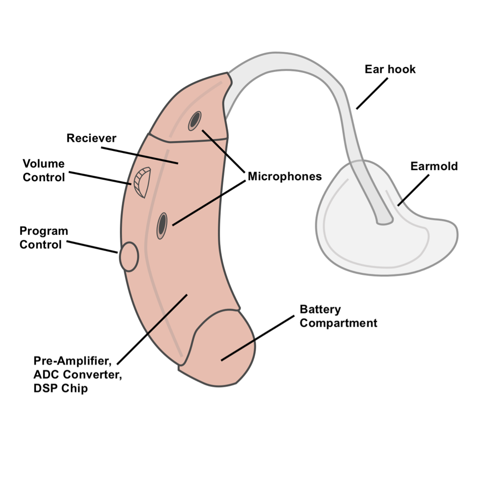 A stylised drawing of a hearing aid.