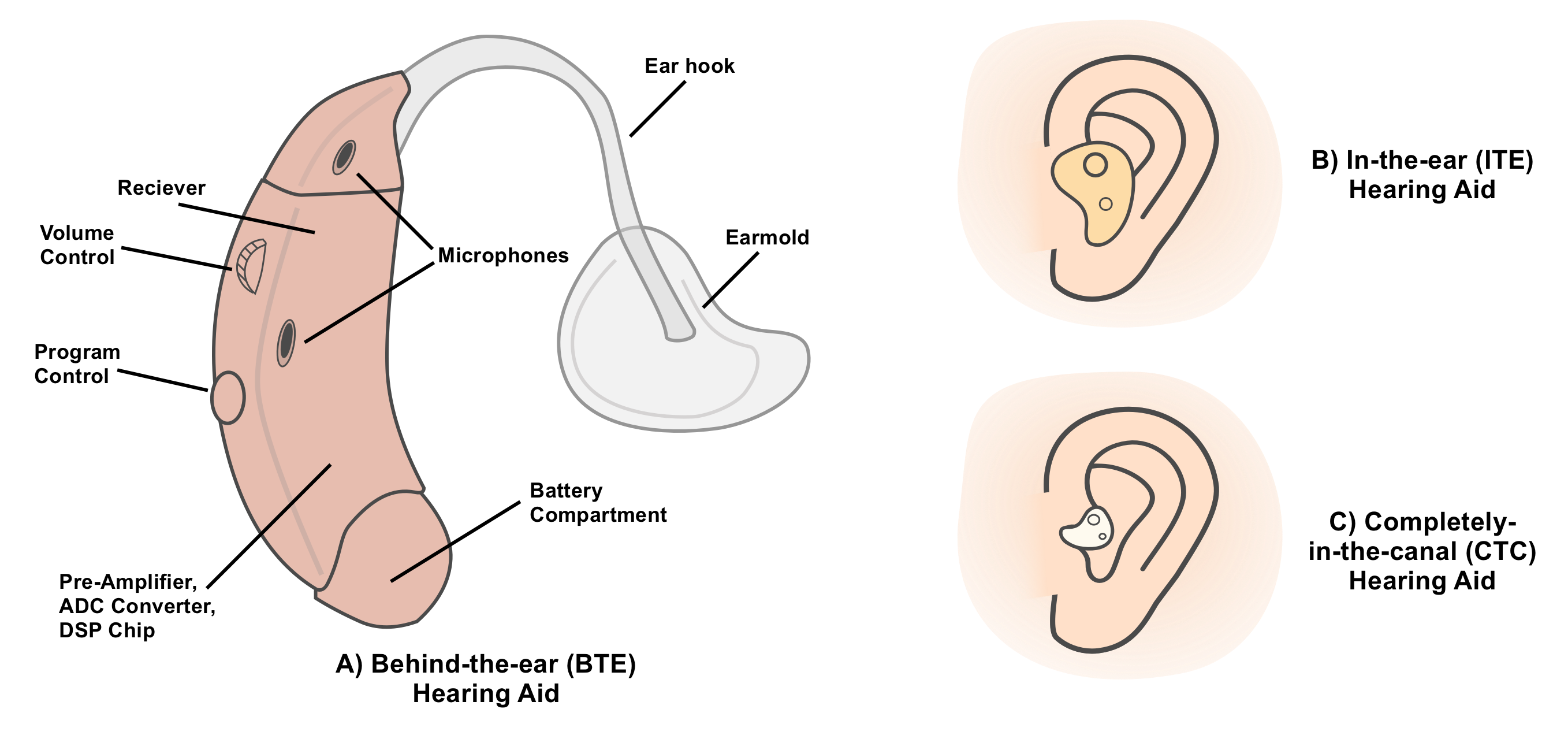 Three different types of hearing aids